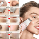 Peeling Ultrassônico Facial Limpeza Profunda