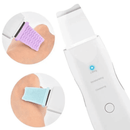 Peeling Ultrassônico Facial Limpeza Profunda